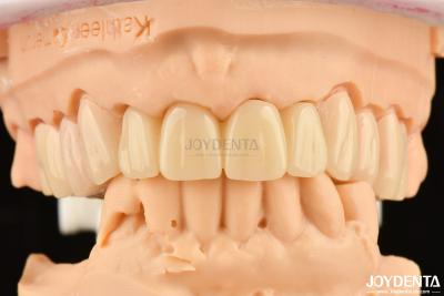 China Biocompatible PMMA M75 Restoration Scratch Resistant For Dental Aesthetics for sale