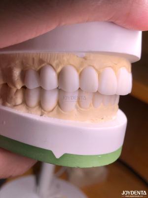 China Customized Digital Diagnostic Wax Ups for Natural Tooth Anatomy Replication for sale