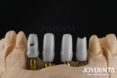 China Custom Dental Implant Zirconia Abutment For Single Or Multiple Unit Restorations for sale