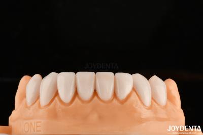 China Enlace fuerte con el esmalte dental para el ajuste seguro de carillas dentales personalización para tonos personalizados para que coincidan con los dientes naturales en venta