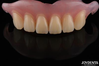 China Natural Looking Dental Complete Denture Odor Resistant Adjustable For Proper Fit for sale