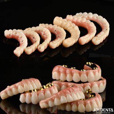 China La corona y el puente implantados son la opción de confianza y probada para la reconstrucción dental en venta