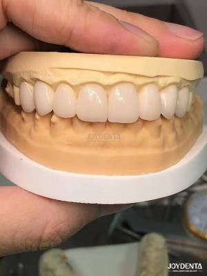 China 16 tons de cor Emax Veneers Dentários A1-A4 Alta resistência a manchas para sorrisos perfeitos à venda