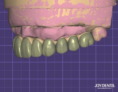 Chine Sécurité des données conforme à la norme HIPAA Modèle 3D numérique pour les modifications dentaires à vendre