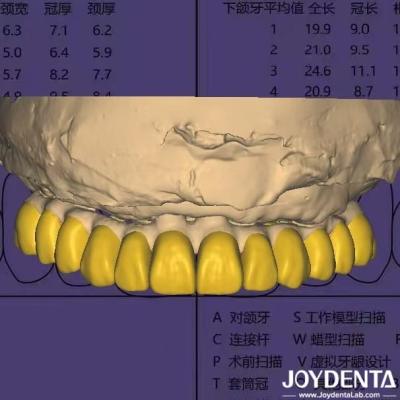 China Dental Design Software Digital Wax Up mit HIPAA-konforme Datensicherheit zu verkaufen