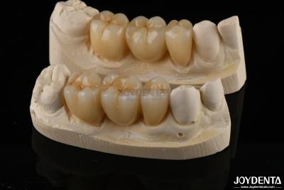 China Wear Resistant Zirconia Full Contour Dental Crown High Translucency for sale