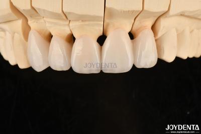 China Highly Customizable Layered Zirconia Dental Crowns And Bridges Long Lasting Solution for sale