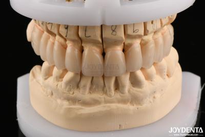 China Polished Surface Flexural Strength Layered Zirconia for Bridges 6.0-6.1 G/cm3 Density for sale