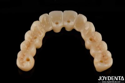 China High Flexibility Zirconia Hybrid Bridge With Titanium Base High Aesthetic for sale