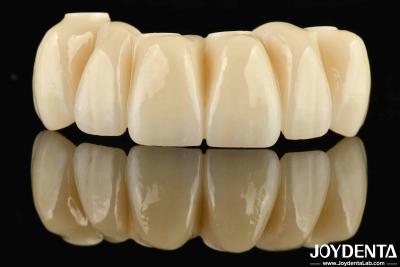 China Dental Restoration Ti-Base Zirconia Hybrid Bridge Natural Looking Precise Fit for sale