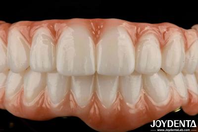 China Long Lasting Titanium Bar Zirconia Hybrid Bridge Natural Looking Aesthetics For Restoring for sale