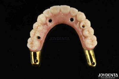 China Wear Resistance Zirconia Hybrid Bridge With Ti-Bar Compatible Natural Teeth And Gums for sale