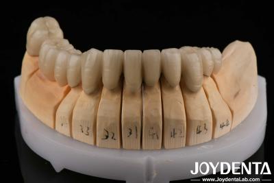 China Gold Alloy PFM Porcelain Fused to Metal Dental Compatible With Porcelain Layering for sale