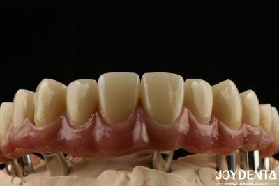 China Titânio Malong Dental Hybrid Bridge Durável Ajustado Fit Baixa densidade à venda