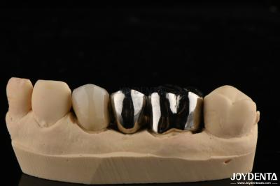 China Coroa de liga de metal resistente à abrasão para restaurações dentárias personalizadas à venda