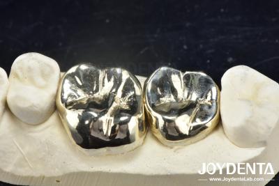 중국 Wax Casting Dental Repair Full Metal Crown For Abrasion Resistant Oral Rehabilitation 소름에 저항하는 구강 재활용을 위한 전체 금속 왕관 판매용