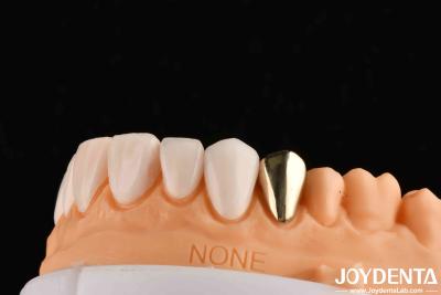 China Wax Casted Gold 60K Metallic Dental Crowns Abrasive Resistant Gold Tooth Crown for sale