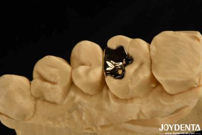 China Coroa Dental Clinical Metálica de Ouro 60K Gold Dental Cap para Reabilitação Oral à venda