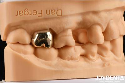 China Abrasion Resistant Wax Casting Dental Materials for Enhanced Oral Rehabilitation for sale