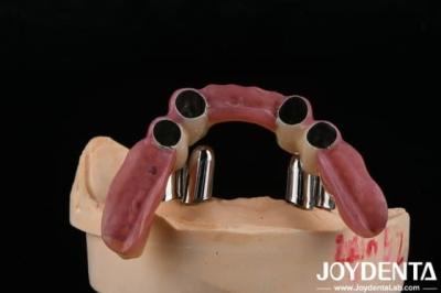 China Dental Precision Attachments Supports Partial Dentures Accurate Restorations for sale