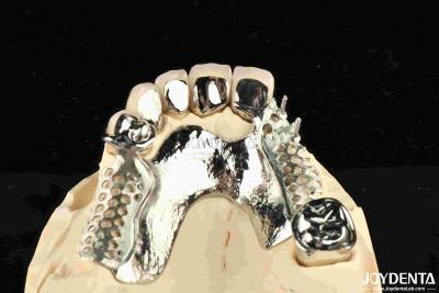 China Alloying Metal Dental Framework Removable Wearable For Dental Practitioners for sale