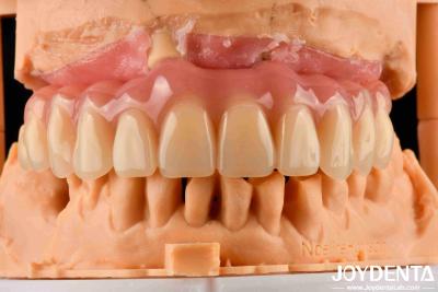 China Comfortable Wear Acrylic Denture Finished With Tooth Arrangement Technology for sale