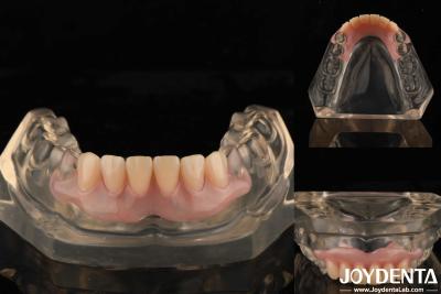 China Tooth Arrangement Technology Flexible Denture Finish High Elasticity Customization for sale