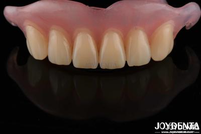 China High Stealth Flexible Removable Denture Finished Comfortable Fit Dental Lab for sale