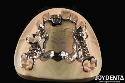 China Material biocompatible dental de estructura metálica de soporte personalizado en venta