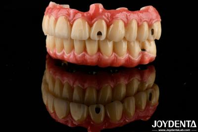 China Excellent Elasticity Dental Acrylic Denture Finish with Lightweight Property for sale