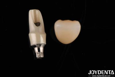 China Zirconia Custom Abutments And Bars Dental Restorations For Individual Patient's Anatomy for sale