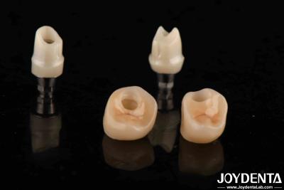 China Silver Color Dental Zirconia Abutments For Implants Customizable Diameter for sale