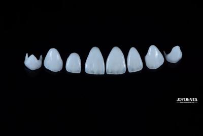 China 0.3-0.5mm Dicke Naturporzellan Emax Veneers Hohe Festigkeit Langlebig für Ästhetik zu verkaufen