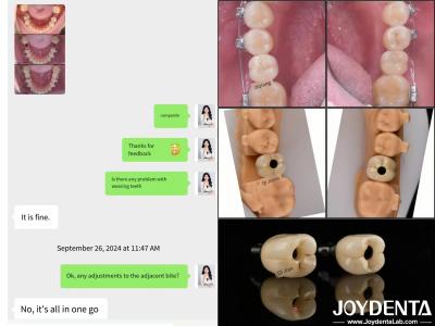 China Implantes Dentários de Arco Completo de Longa Duração Implantes Endossais Comprimento 10mm-16mm à venda