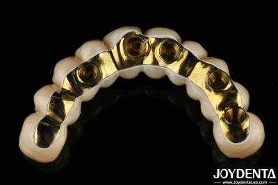 China Custom Made Ti-Bar Zirconia Hybrid Bridge Precision Fit Dental Prosthesis for sale