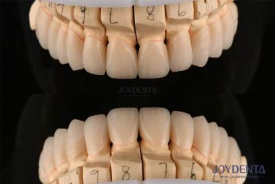 China Polished Layered Dental Zirconia 0.3-0.5mm Thickness With CAD CAM Technology for sale