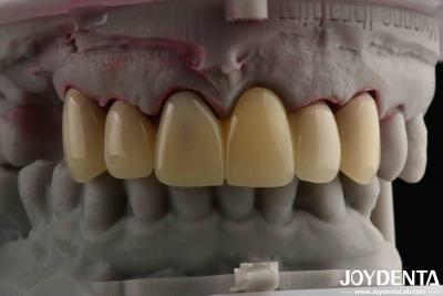 China CAD CAM Processing Dental PMMA Material Multilayer Design For Natural Shade Transitions for sale