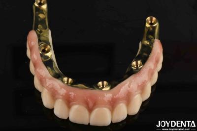 China Tandheelkundige prothese Ti-Bar Zirconia Hybride brug met hoge biologische compatibiliteit Te koop