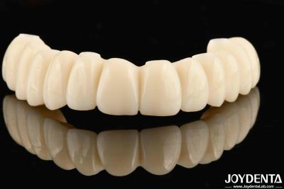 China Aanpasbare Ti-Base Zirconia Hybrid Bridge met uitstekende duurzaamheid en goede biocompatibiliteit Te koop