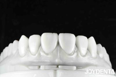 China Revolucione sua prática odontológica com a morfologia natural dos dentes, tecnologia de arranjo dentário e propriedade leve à venda