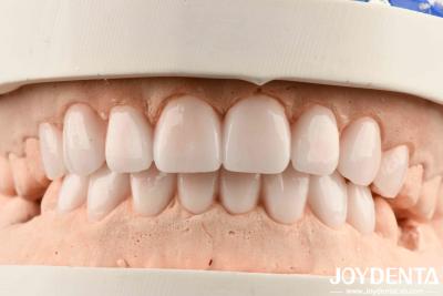 China Materiais diversos e boa elasticidade no acabamento de dentaduras flexíveis para metais e resinas à venda