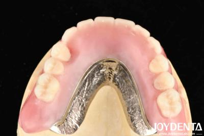 China Conecte firmemente a linha de dentes Tecnologia elaborada para profissionais dentários e resultado preciso à venda