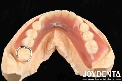 China Metálicos e Resinas Estrutura Definição De Dentes Finish Para Estrutura Oral Estável Em Configuração Dental à venda