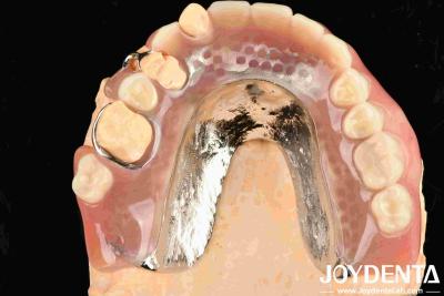 China Quadro bonito e harmonioso Instalar acabamento de dentes para salas de tratamento dentário à venda