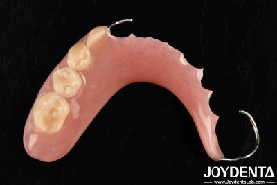 China Desenvolver uma tecnologia para estrutura oral estável estrutura dentária de acabamento em aplicação dentária à venda