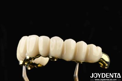 China Comfortable To Wear Ti-Bar Zirconia Hybrid Bridge Restores Chewing Function Compatible With Natural Teeth And Gums for sale