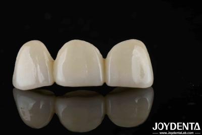 China Natural-looking Style With Layers Full Zirconia High Translucency And Aesthetics for sale