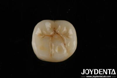 Cina Alta traslucidità Zirconia piena con strati Biocompatibilità e resistenza flessibile di 800 MPa in vendita