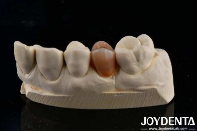 Cina Biocompatibile e dall'aspetto naturale Multilayer Full Zirconia con estetica in vendita