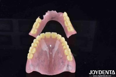 China Advanced Tooth Arrangement Technology Acrylic Denture Finish With Good Elasticity And Diverse Features for sale